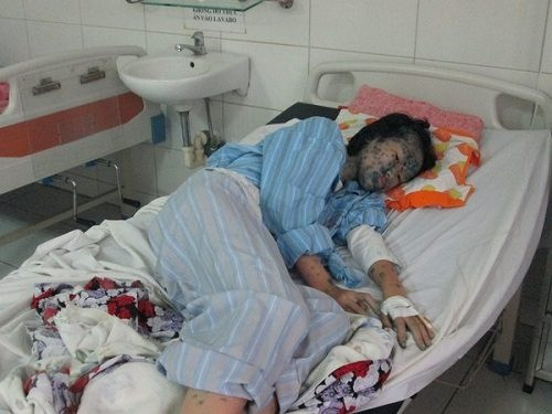 Hình ảnh đáng thương khi bị thủy đậu được dân mạng đăng tải để nhắc nhở nhau cần phòng bệnh hơn chữa bệnh. Ảnh: Sưu tầm Facebook.