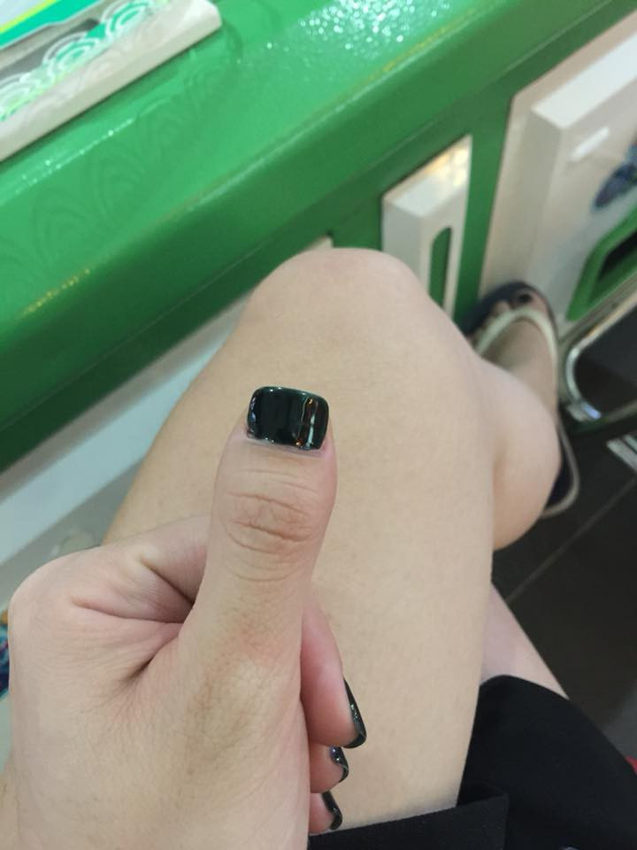 Trên MXH Facebook xuất hiện bài đăng của 1 bạn nữ có tài khoản Lê Hiền với hình ảnh ngón tay cái kỳ lạ của mình kèm dòng trạng thái: "Ở đây có ai có kiểu ngón tay cái mà giống y như cái ngón chân không? Để ai nhìn thấy là y như rằng mình bị quê liền. Nói rằng tui không cô đơn đi".