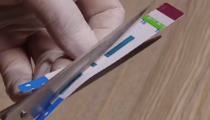 Benh vien Xanh Pon che doi que thu HIV: Tang thanh tra hoat dong xet nghiem