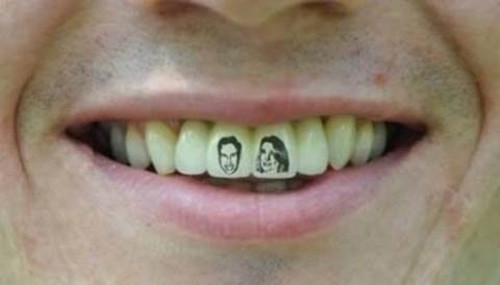 Thời gian gần đây, giới trẻ rộ lên mốt xăm răng, thay vì chỉ ghi dấu trên những vùng cơ thể có da thịt. Kiểu xăm này ngay lập tức gây chú ý. Muốn có một hình dạng này, các bạn trẻ phải đưa răng cho nha sĩ, thợ xăm thực hiện rồi mới gắn lại vào vị trí cũ và mất từ 75-200 USD tuỳ lựa chọn.