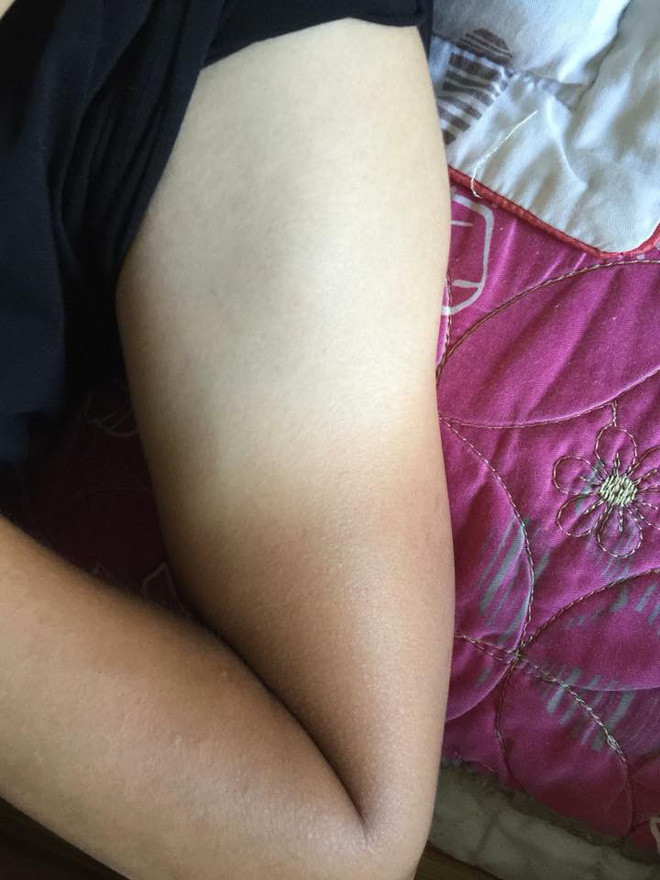 Chính bởi vì việc sợ cháy nắng mùa hè, nhiều người ra đường với khẩu trang, áo chống nắng, găng tay che kín mặt mũi và được dân mạng gọi đây là team Ninja.