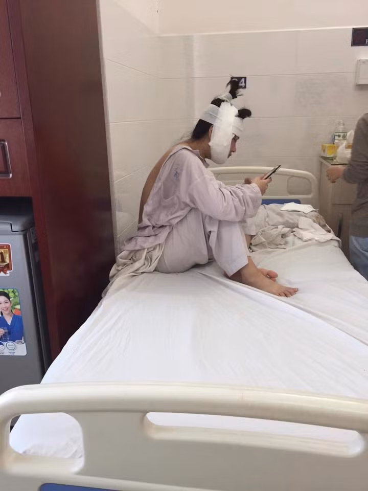 Những bức ảnh băng bó chằng chịt khuôn mặt của Kiều Anh được dân mạng truyền tay nhau rất nhanh và có vô vàn những câu chuyện được cộng đồng mạng bàn tán xung quanh lần dao kéo này của nữ streamer thị phi này.