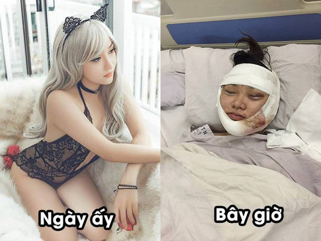 Theo đó, cô nàng mặt bị sưng tấy vì can thiệp phẫu thuật, tóc tai rối bời không còn nhận ra Kiều Anh Hera xinh đẹp ngày nào.