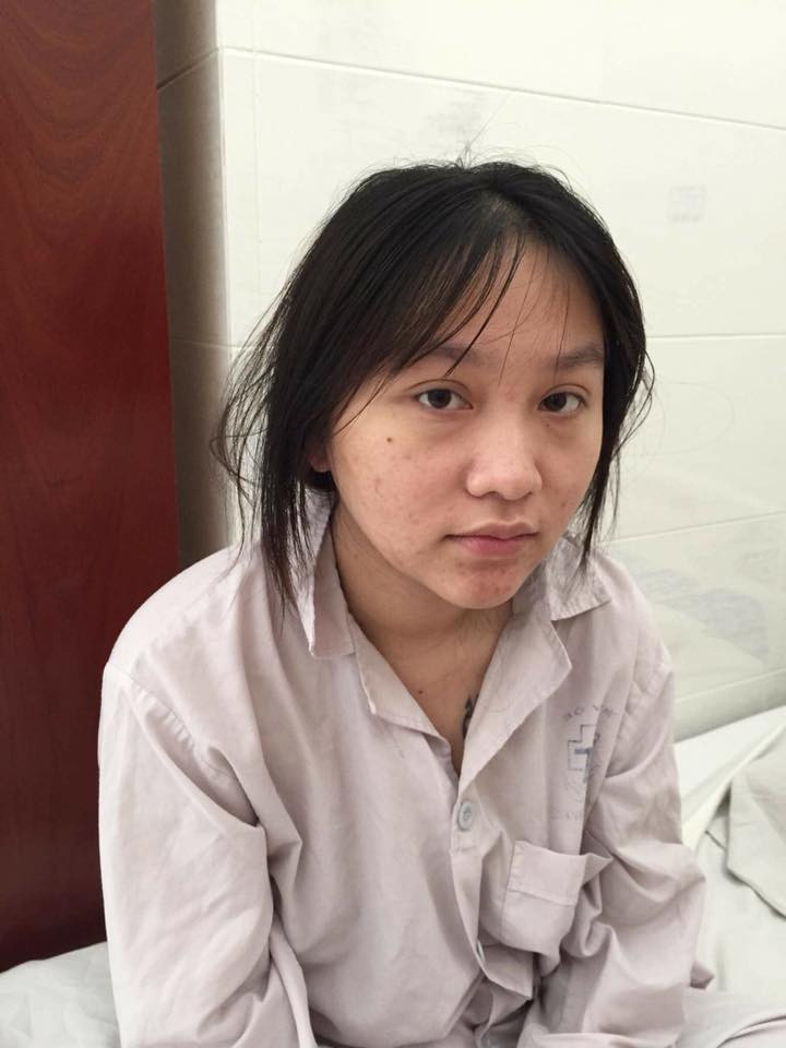 Rất nhiều ý kiến đặt nghi vấn Kiều Anh tiến hành can thiệp dao kéo sau thời gian bị chê "tã".