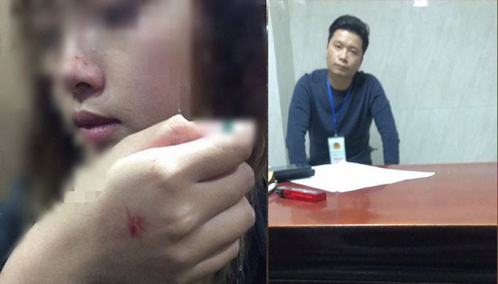 Gây ra chấn thương cho cô gái, gã biến thái tên Hùng bị gọi lên xử phạt hành chính với mức chỉ là 200.000 đồng.