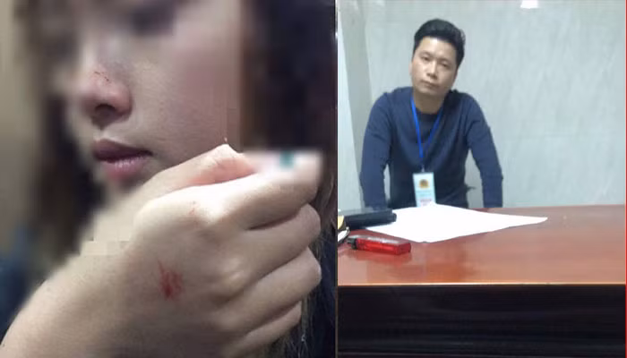 Gây ra chấn thương cho cô gái, gã biến thái tên Hùng bị gọi lên xử phạt hành chính với mức chỉ là 200.000 đồng.