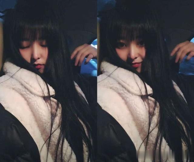 Đối với con gái mỗi thời đều có chuẩn mực vẻ đẹp riêng. Cách đây vài năm, khuôn mặt V-line trở thành một trào lưu làm đẹp cực thịnh hành. Bởi vậy mà không ít cô gái có gương mặt tròn, má bánh bao đều tìm đến các phương pháp phẫu thuật thẩm mỹ hoặc tiêm filler để có mặt V-line.