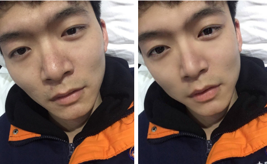 2 bức ảnh chứng minh tầm quan trọng của một chiếc cằm v.line, nhìn anh chàng này điển trai lên trông thấy.