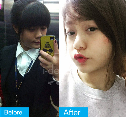 Trào lưu mạng xã hội "ngày ấy và bây giờ" cho thấy sự thay đổi từ vịt con xấu xí ngày nào giờ đã tung cánh thành thiên nga khiến bao đấng mày râu phải xếp hàng xin yêu.