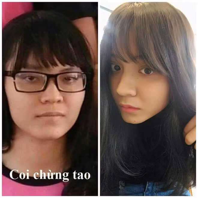 Có thể ngày xưa nghĩ rằng: "Dù có lớn lên mình vẫn sẽ chung thân với cái "đít chai" (kính cận) nhưng khi công nghệ phát triển thì chỉ cần thích là sẽ có một đôi mắt đẹp và vĩnh biệt với biệt danh "4 mắt" ngày xưa".