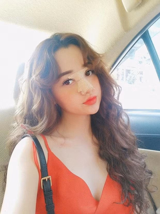 Trương Ngọc Trân (SN !995) hiện đang sinh sống và làm việc tại Hồ Chí Minh. Để có gương mặt đáng chú ý như hiện tại, cô nàng 9X này trải qua 1 lần giảm cân cùng 3 lần lên bàn phẫu thuật thẩm mỹ.