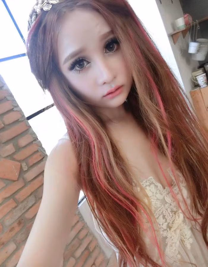 Xuất phát từ mục đích muốn bản thân trở nên xinh đẹp hơn, trưởng thành hơn, Vân quyết định phẫu thuật thẩm mỹ và nhận được sự ủng hộ, khích lệ từ gia đình.