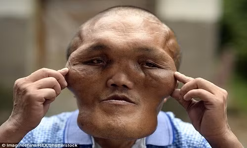 Bi nham la nguoi ngoai hanh tinh vi khuon mat ky di-Hinh-3