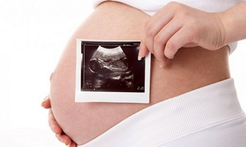 Xet nghiem sang loc truoc sinh co gay tai bien Y khoa?