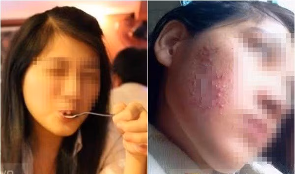 Ngay sau khi bức ảnh cùng dòng trạng thái của H.O trên mạng xã hội đăng tải đã thu hút được sự chú ý của cộng đồng mạng. Đa số mọi người đều đồng tình rằng đối với các sản phẩm chăm sóc da thì phải tìm đến những thương hiệu uy tín. Đừng ai dại dột đưa mặt để thử nghiệm bất cứ một loại sản phẩm dưỡng da không rõ nguồn gốc xuất xứ.