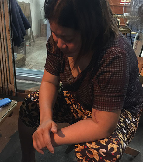 Uan khuc vu thue chat chan tay nham truc loi bao hiem