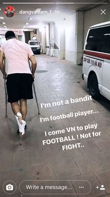 Những ngày qua, mọi thông tin về cuộc xô xát giữa thủ môn Văn Lâm và Sỹ Mạnh thu hút sự quan tâm của cộng đồng những người yêu bóng đá Việt Nam. Mọi thông tin mới nhất về vụ ẩu đả này được cập nhật liên tục, mới đây nhất, Sỹ Mạnh đã lên tiếng xin lỗi về hành động của mình với NHM nhưng vị trợ lý HLV CLB Hải Phòng này một mực không chịu xin lỗi thủ thành Đặng Văn Lâm (nạn nhân). Ảnh: Instagram.