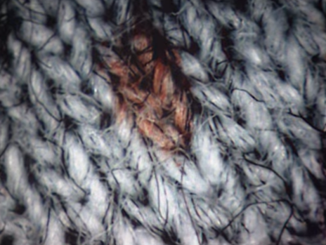 Nhờ hình ảnh phóng to hàng nghìn lần, họ đã thấy vài vết máu trên áo, bao gồm hai vết ở phía sau ống tay. Vị trí đó cho thấy David đã vươn cánh tay và hướng xuống phía dưới khi máu văng vào áo anh ta. Tư thế đó phù hợp với kịch bản anh ta đứng sát Sandra rồi bắn cô khiến máu từ đầu nạn nhân văng vào áo.