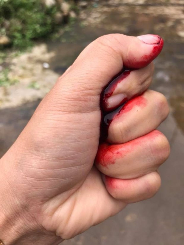 Tro dua kinh di cua co vo khien chong ngat xiu-Hinh-2