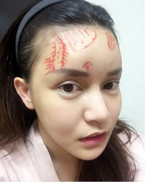 Từ một cô gái vô cùng bình thường không có gì nổi bật, thậm chí bị cho là xấu xí, Vanrisa Namirach đã quyết định thay đổi để lột xác thành “thiên nga” sau ca phẫu thuật thẩm mỹ tại Hàn Quốc.