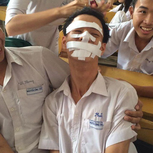 Băng bó từ đầu đến chân như "trói gà" bảo sao chiến sĩ này chỉ biết cười ra nước mắt.