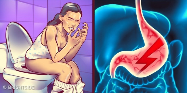 Táo bón: Các loại thịt đỏ như thịt bò, thịt lợn hay thịt cừu... chứa nhiều chất béo và sắt, cần nhiều thời gian hơn để tiêu hóa. Và nếu không tiêu hóa hết, chúng có thể gây khó tiêu vào ngày hôm sau. Bên cạnh đó, thịt đỏ chứa ít chất xơ, dưỡng chất cần thiết thúc đẩy sự vận động của ruột. Lời khuyên: Chỉ nên ăn 100-200 g thịt đỏ khoảng 2 lần/tuần với nhiều loại rau xanh hoặc ngũ cốc.