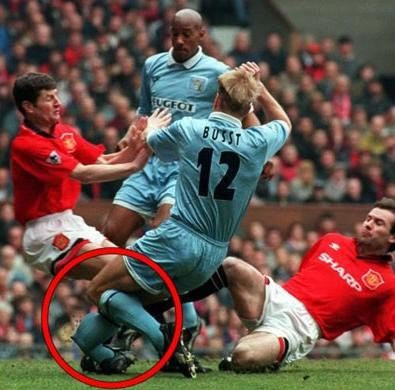 Pha va chạm với hai cầu thủ MU là Denis Irwin và Brian McClair khiến hậu vệ đội Coventry City - David Busst - gãy chân trong một trận đấu năm 1996. Hậu vệ này sau đó phải trải qua gần 20 cuộc phẫu thuật để có thể đi lại bình thường và phải chấm dứt luôn sự nghiệp.