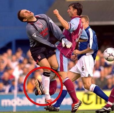 Tiền đạo người Bỉ của Aston Villa, Luca Nilis cũng phải sớm kết thúc sự nghiệp vì gãy chân trong pha va chạm với với thủ môn đội Ipswich, Richard Wright trong trận đấu tại giải Ngoại hạng Anh năm 2000.