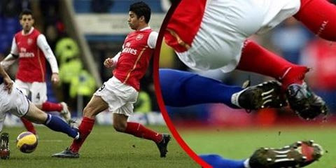 Sự nghiệp đang lên nhanh ở Arsenal của Eduardo đã khựng lại từ ngày 23/2/2008, khi chân trái của anh gãy gập vì cú vào bóng ác hiểm của cầu thủ Birmingham, Martin Taylor.