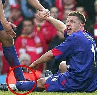 Gãy chân cũng là lý do chính khiến sự nghiệp của Alan Smith tại MU sớm đi đến hồi kết. Nhưng cách cựu tiền đạo Leeds dính chấn thương này trong trận đấu với Liverpool năm 2006 cũng rất hy hữu. Cú tiếp đất không chuẩn sau khi nhảy lên cản pha đá phạt của John Arne Riise khiến Smith vừa bị gãy chân, vừa bị lệch mắt cá.