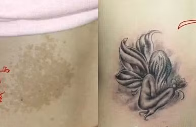 Trên cơ thể sẽ không thiếu những vết sẹo, chúng có thể đến do bẩm sinh hoặc do những tai nạn trong cuộc sống thường ngày. Nhiều người đã tỏ ra vô cùng lo lắng với những vết sẹo xấu xí, thế nhưng các bạn sẽ không phải lo khi đã có những hình xăm che sẹo hết sức nghệ thuật.