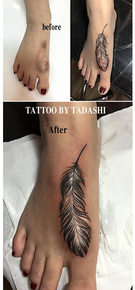 Xăm mình che khuyết điểm khiến nhiều người vượt qua được nỗi tự ti, mặc cảm về cơ thể.