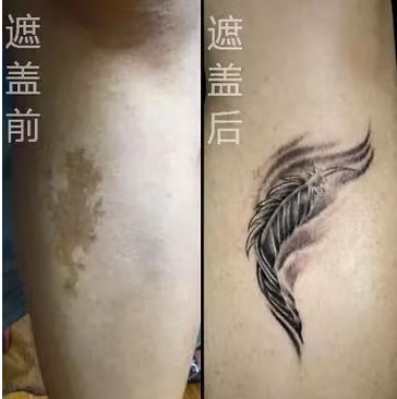 Chỉ với những hình xăm nghệ thuật, vết chàm gần như đã biến mất trên cơ thể.