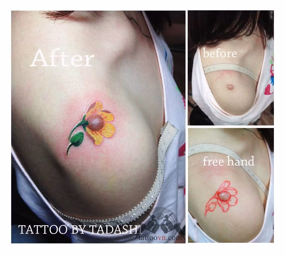 Chắc chắn nhiều người sẽ xóa bỏ những “ác cảm” với hình xăm khi biết chúng làm cho những người bị những vết sẹo trở nên tự tin.