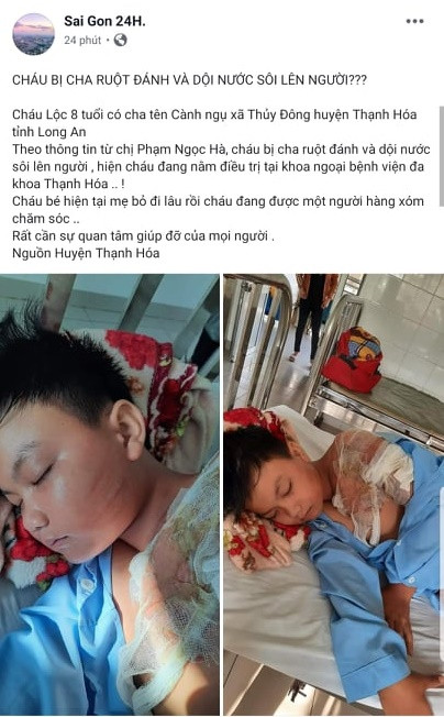 Thuc hu chuyen bo de danh va doi nuoc soi len nguoi be trai 8 tuoi?