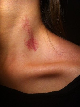 Theo đó, dù có thích "đánh dấu" nhau bằng những vết hôn đến mức nào thì cũng nên hạn chế, đừng sử dụng quá nhiều sức lực, nếu không sẽ gây nguy hiểm trực tiếp cho nửa kia của mình.