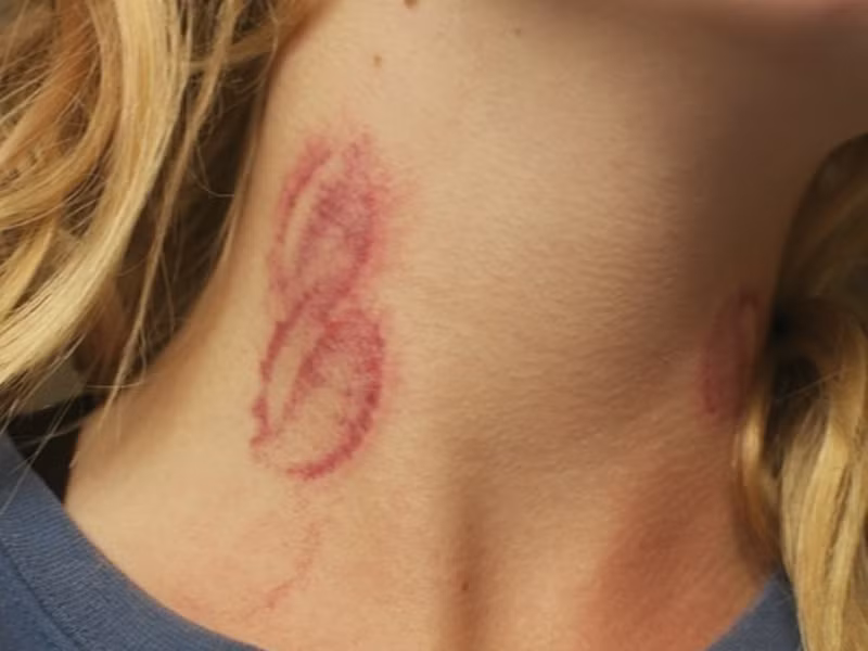 Việc con gái đột ngột ra đi khiến cả gia đình Tiểu Nha cảm thấy cực kì sốc. Chia sẻ với mọi người, bố của cô gái cho biết sức khỏe con mình từ trước tới nay vẫn rất tốt, chưa từng bị bệnh gì quá nặng.