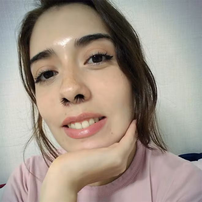 "Thực sự hãi hùng khi nhìn vào những chiếc lỗ mũi thon gọn này lại mọc tua tủa những nhúm lông đen xì" là nhận xét của nickname Kenny Fine trên trang cá nhân sau khi thành viên này chia sẻ clip của @gret_chen_chen.