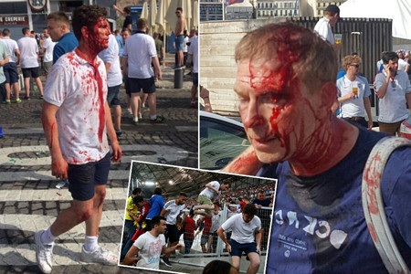 Máu đã đổ trên người của CĐV của hai bên. Điều này khiến cho mong muốn kỳ Euro 2016 trở nên thanh bình và đầy màu sắc của BTC bị phá sản.