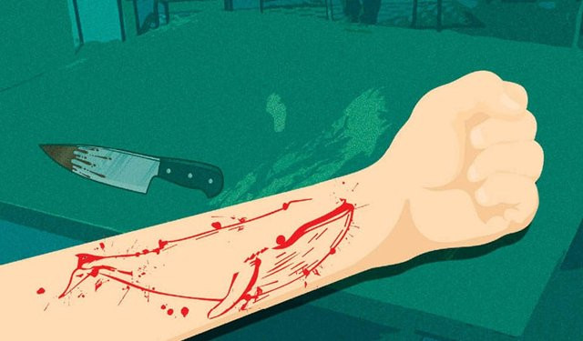 "Thử thách Cá voi xanh" dẫn dắt người chơi thực hiện nhiều việc làm khác nhau, từ bình thường đến nguy hiểm, từ nhẹ nhàng đến "đẳng cấp cao", như trao đổi trên mạng về cá voi xanh; xem phim Cá voi xanh; xem phim kinh dị; vẽ hình cá voi xanh (bằng bút bi) lên cơ thể; sử dụng dao, lưỡi lam hoặc kim khâu để tạo hình dáng cá voi lên cánh tay hoặc chân.