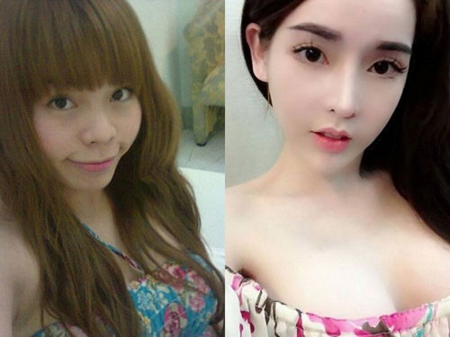 Vân Tokyo là hot girl được cư dân mạng biết tới bởi vẻ đẹp "dao kéo". Vân Tokyo đã nâng mũi, chỉnh gò má, gọt hàm, độn cằm, chỉnh răng, bơm môi, bơm ngực và hút mỡ toàn thân. Thậm chí, mới đây nhất, Vân còn đăng tải ảnh mình phẫu thuật kéo chân tại bệnh viện.