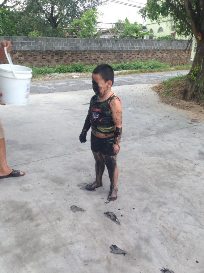 Mới đây, trên MXH đang lan truyền chóng mặt một đoạn video ghi lại hậu quả của một cậu bé mới tập xe đạp và bị ngã xuống mương.