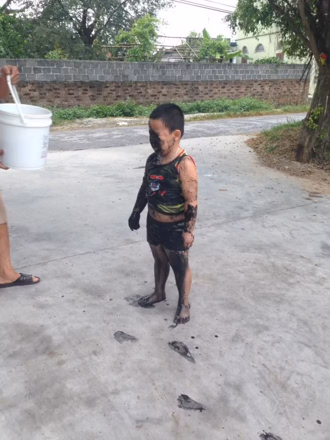 Mới đây, trên MXH đang lan truyền chóng mặt một đoạn video ghi lại hậu quả của một cậu bé mới tập xe đạp và bị ngã xuống mương.