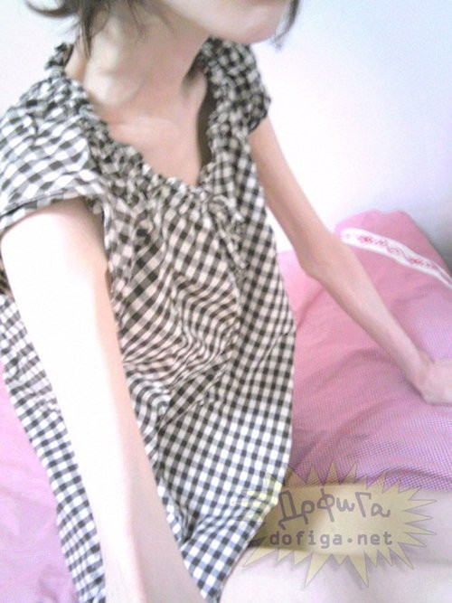 Các thành viên trên một số trang diễn đàn của Nhật Bản đang bị một phen bàng hoàng khi chứng kiến những bức ảnh chân thật của một cô gái giống như "bộ xương di động" vì gầy.