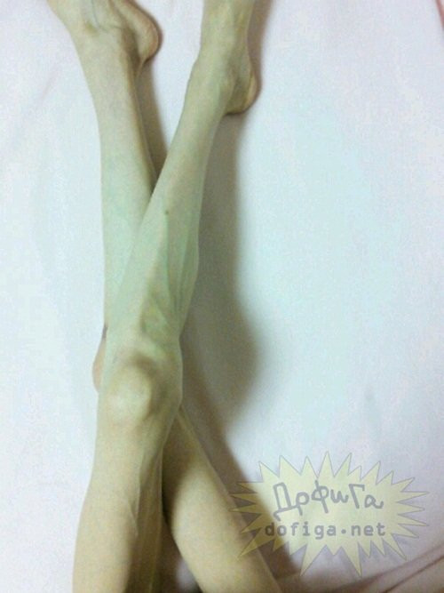 Trên thế giới từng xuất hiện một vài cô gái có thân hình gầy guộc như vậy, nhưng họ vẫn có cân nặng trên 30kg. Do đó, việc cô gái người Nhật Bản này chỉ nặng 26,9kg khiến nhiều người thực sự hoang mang, ngỡ ngàng.