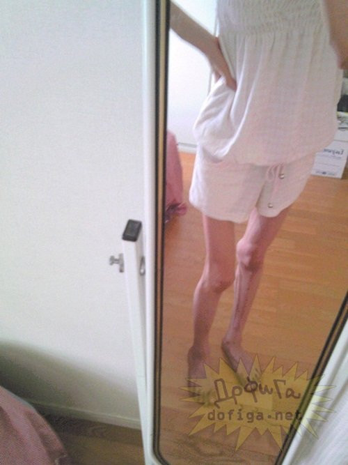 Khi cô gái gầy gò này mặc trong những bộ quần áo mùa đông hay mùa hè, người ta không khó để thấy rõ cơ thể của cô bị lọt thỏm trong đống vải. Điều đáng nói thêm nữa, dù có thân hình như vậy, cô gái vẫn rất "chịu khó" chụp khá nhiều ảnh "tự sướng" và chụp ở cự ly gần để mọi người thấy rõ độ gầy của mình.