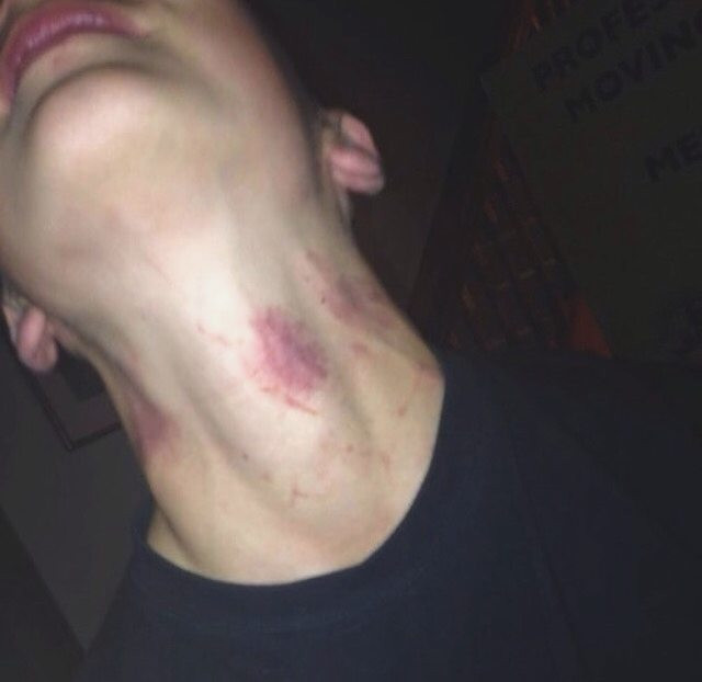 Chứng kiến sự việc, những người xung quanh lập tức đưa anh chàng xấu số vào bệnh viện để cứu trị nhưng không kịp, chàng trai bất hạnh trút hơi thở cuối cùng ở phòng cấp cứu.