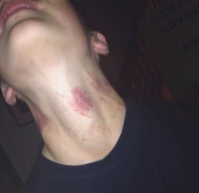 Chứng kiến sự việc, những người xung quanh lập tức đưa anh chàng xấu số vào bệnh viện để cứu trị nhưng không kịp, chàng trai bất hạnh trút hơi thở cuối cùng ở phòng cấp cứu.