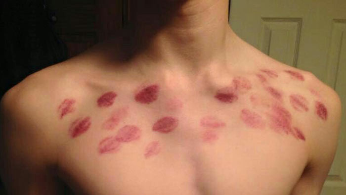 Được biết, khi bạn gái của chàng trai nghe được nguyên nhân chính xác dẫn đến cái chết của người mình yêu, cô đã bật khóc nức nở và ngã quỵ vì mình là thủ phạm dẫn đến cái chết của bạn trai.