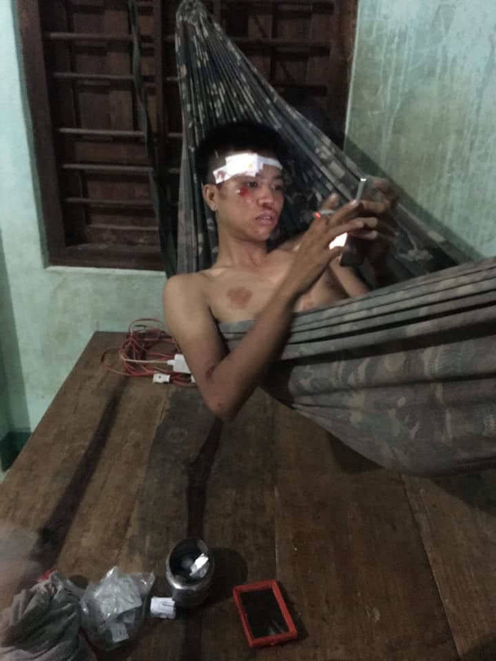 Hai thanh niên bị ngã và xước nhiều chỗ trên mặt, trên thân thể. Đây là cái kết mặc dù đã được cảnh báo từ trước nhưng họ vẫn làm ngơ.